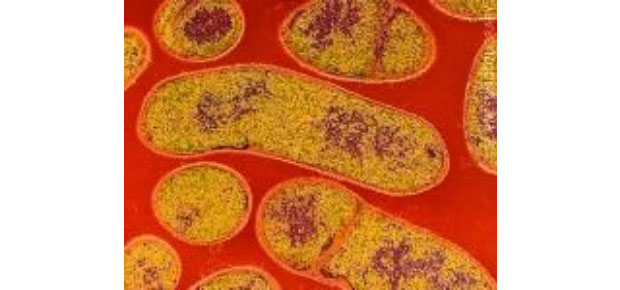 Fotografia al microscopio elettronico del C. botulinum, tratta da National Enteric Disease Surveillance: Botulism Surveillance Overview, pubblicato dal National Center for Emerging and Zoonotic Infectious Diseases –Division of Foodborne, Waterborne, and Environmental Diseases